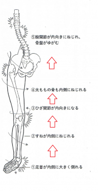下肢の捻れ