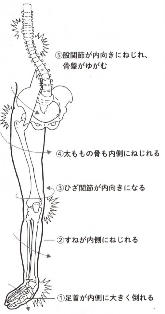 歪み