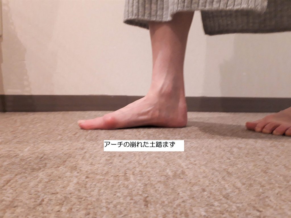 アーチサポートなし_R