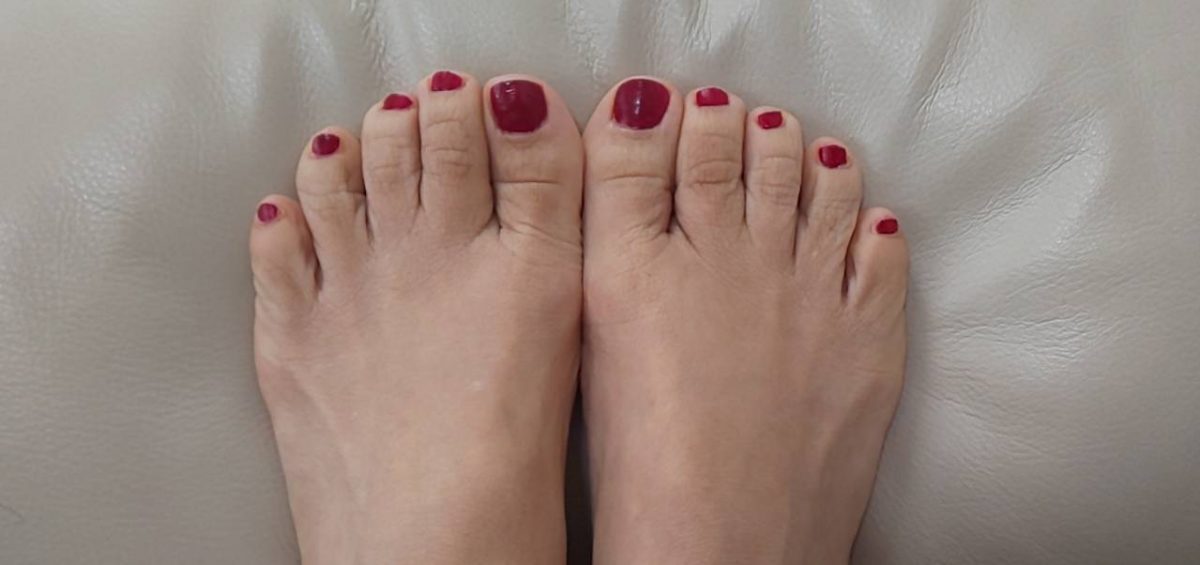 爪の変色がよくなってきました Foot Master